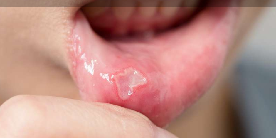 FP-AOUT22lesaviezvous&actu